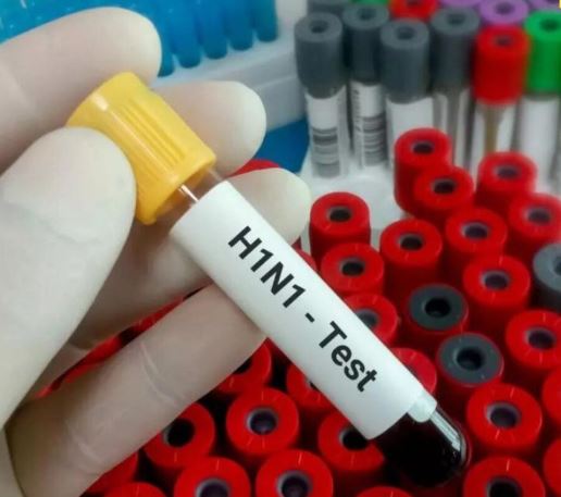 ગુજરાતમાં ઈન્ફ્લુએન્ઝા H1N1ના કેસોમાં ધારો, કોરોના કરતાં ત્રણ ગણો વધારે મૃત્યુદર, હવામાન અને પ્રદૂષણ ચેપી રોગ ફેલાવામાં મુખ્ય કારણ