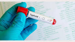 ગાંધીનગરમાં ટાઈફોઈડનો કહેર: એક બાળકનું શંકાસ્પદ મોત, બેની હાલત ગંભીર – પીવાના પાણીમાં ગંદકી ભળતાં 152 દર્દીઓ સારવાર હેઠળ, તંત્ર એલર્ટ મોડમાં.v