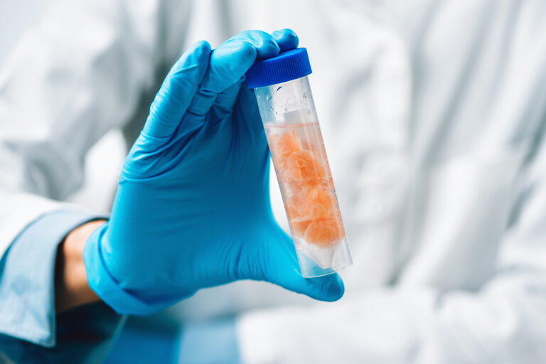 ઉનાળાની સિઝનમાં જામનગરમાં ફૂડ સેફ્ટીનો કડક ચેકિંગ ડ્રાઇવ: ૧૩ નમૂનાઓ લેવાયા, ૫૬.૫ કિલો બિનમાન્ય ખાદ્ય પદાર્થ નાશ.